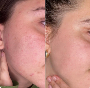 Lisseur à poils sonique