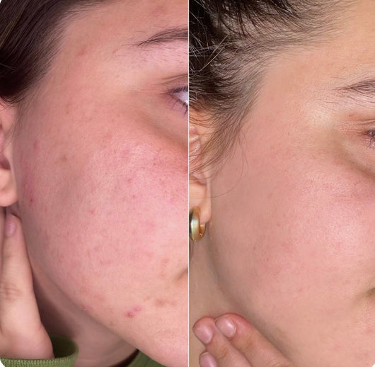 Lisseur à poils sonique