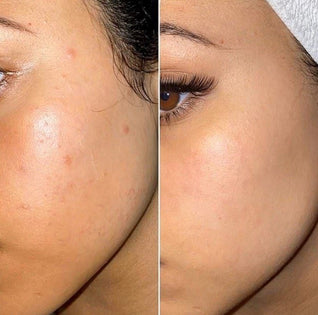 Lisseur à poils sonique