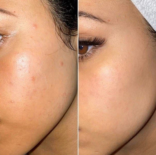 Lisseur à poils sonique